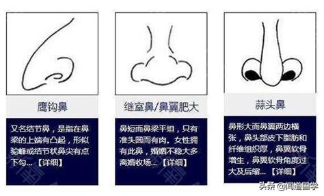 鼻孔三角形 面相|鼻相分析10款｜鼻樑有節及橫紋、豬膽鼻、鼻頭下垂代表甚麼？姻 